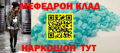 мет Обнинск